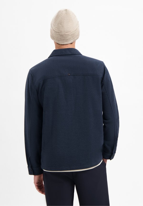 NO EXCESS BUTTON CLOSURE