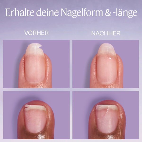 Nagelpflege Set Break Fix Nagelfixierer & On a roll Apricot Cuticle Oil essie