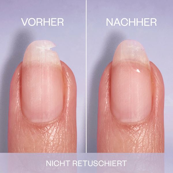Nagelpflege Set Break Fix Nagelfixierer & On a roll Apricot Cuticle Oil essie