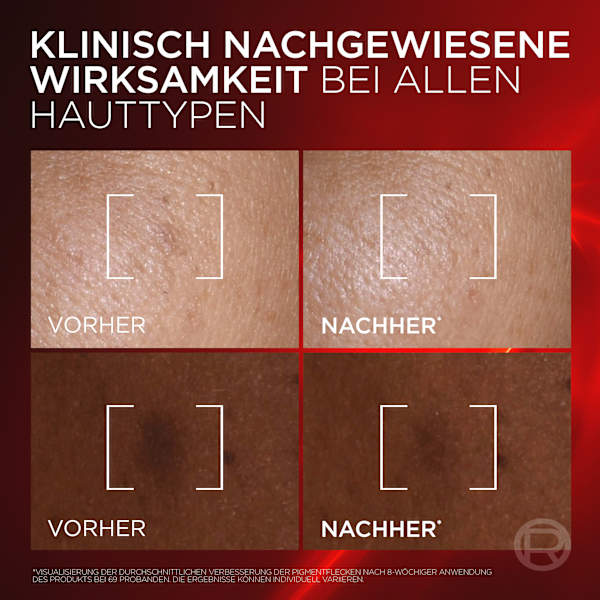 Anti Age Gesichtsserum Revitalift Laser Dreifach Laser L'ORÉAL PARiS