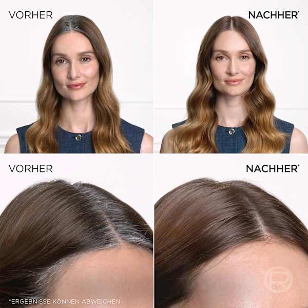 Ansatzspray Braun bis Mittelbraun L'ORÉAL PARiS MAGIC RETOUCH