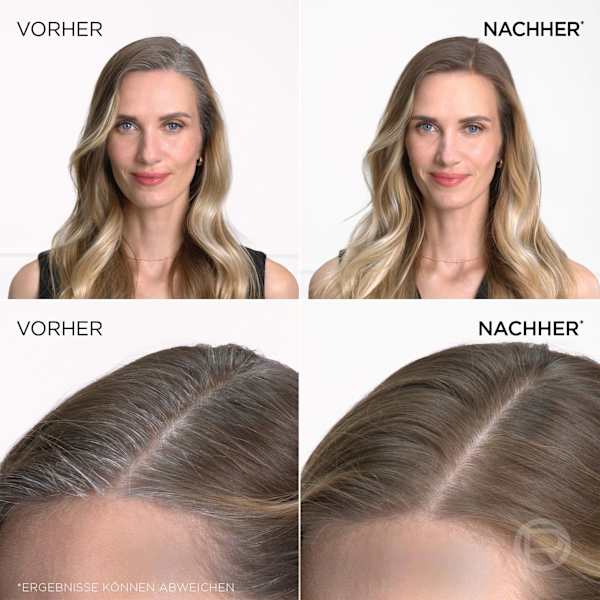 Ansatzspray Dunkelblond bis Hellbraun L'ORÉAL PARiS MAGIC RETOUCH