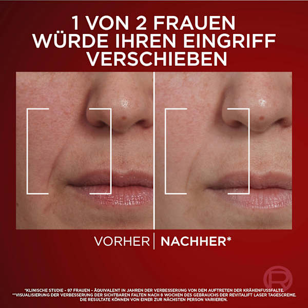 Anti-Aging Laser Gesichtscreme mit Pro-Retinol, Hyaluronsäure und Vitamin C L'ORÉAL PARiS REVITALIFT