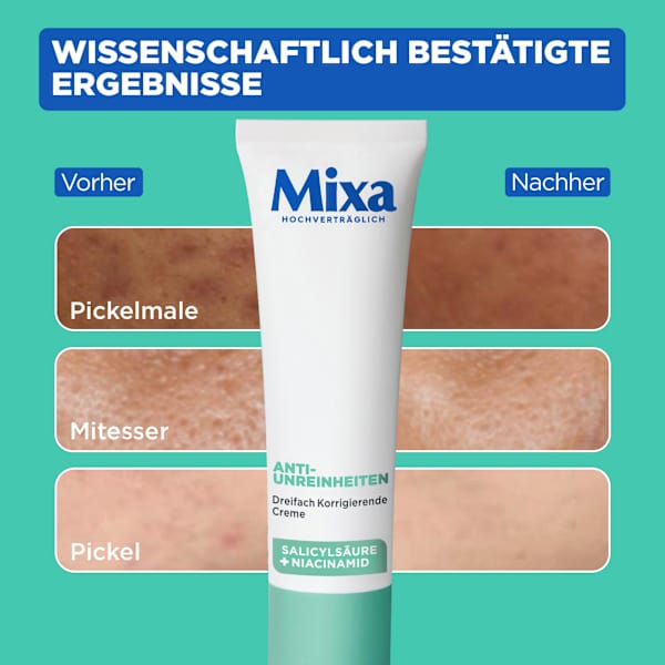 Anti Pickel Gesichtscreme korrigierend Mixa