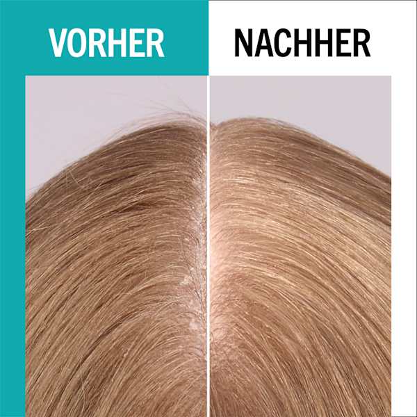 Shampoo scalp balance sanft Schwarzkopf GLISS