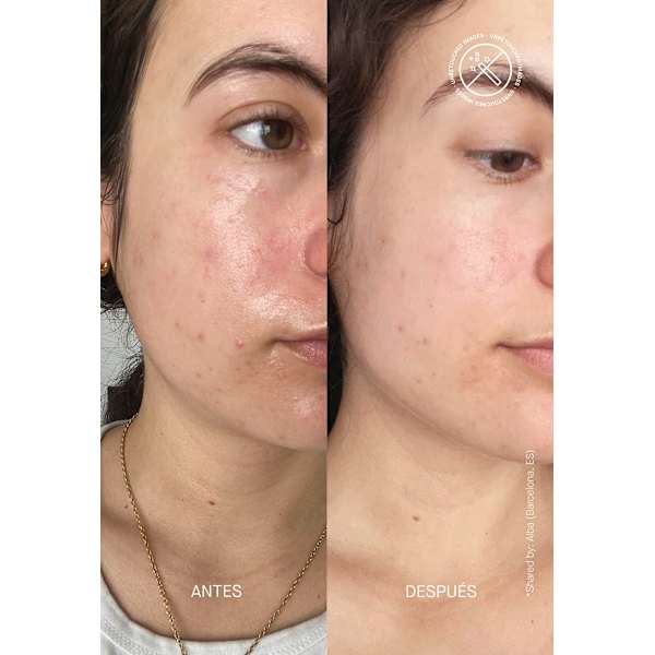 Gesichtscreme Barrier Restoring Hydrating Transparent Lab